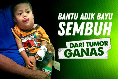 Tumor Ganas Gerogoti, Bantu Bayu Dan Anak Dhuafa Lainnya Bisa Sembuh